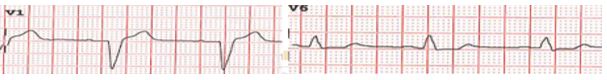 Test Yourself: The ECG Quiz Part 2 - ECG Training